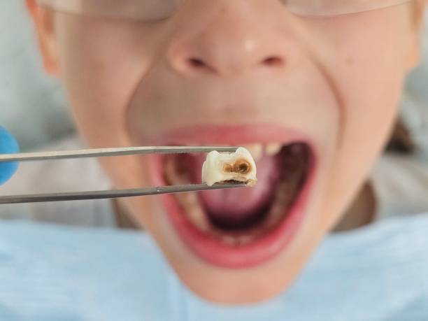 Best Pediatric Emergency Dentist in Ironwood, MI